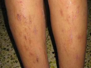 ������Ƥ��������ô��